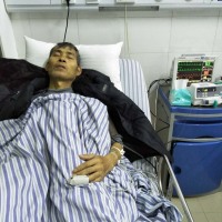 卢松球_弥漫性肝癌,慢性乙型病毒性肝炎 肝硬