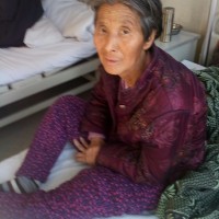 因母亲脑出血后遗症腿骨头摔坏