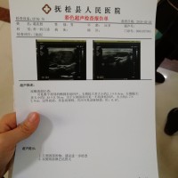 口咽癌,求你不要夺走我的生命!