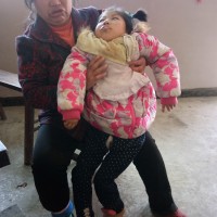 奶奶!我想摆脱小儿痉挛型脑瘫,不想让你太累