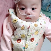宝宝先心病,请大家帮帮忙