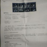 军人亲属,愿您用爱心延续生命