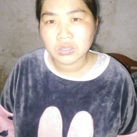 不孕不育夫妻跪求爱心救助早产重症试管婴儿!