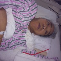 大病手术|患者:杨玉兰|疾病:1垂体瘤术后,2脑脊