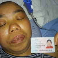 不想让因身上肉骨折了十几一根夺走我最爱的妈