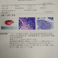 帮帮我!让身患甲状腺恶性肿瘤的我在人世上活