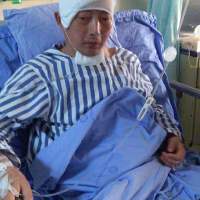 邓付明_右侧额颞岛叶、基底节区胶质瘤_证明