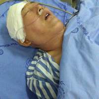 邓付明_右侧额颞岛叶、基底节区胶质瘤_证明