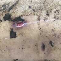 家庭已经无力负担治疗费用了