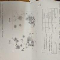 拜托了!不要让重症肺炎从我手中夺走她!