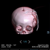 张家彬_左颞部囊性肿物_证明材料
