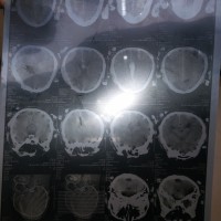 生命接力!希望大家可以帮助刘彦辉活下去。