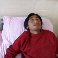 我!|患者:李海军|疾病:慢性纤维空洞型肺结核毁