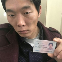 小细胞恶性肿瘤,正在折磨这个孩子帮帮他吧