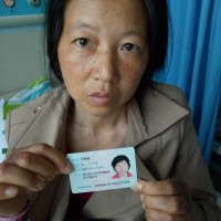 刘银娥_室管膜瘤_证明材料