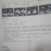 淇|疾病:先天性心脏病:法洛四联症,房间隔缺损。