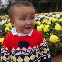 淇|疾病:先天性心脏病:法洛四联症,房间隔缺损。