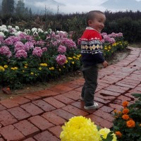 淇|疾病:先天性心脏病:法洛四联症,房间隔缺损。