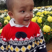 淇|疾病:先天性心脏病:法洛四联症,房间隔缺损。