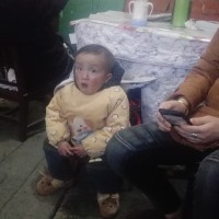 淇|疾病:先天性心脏病:法洛四联症,房间隔缺损。