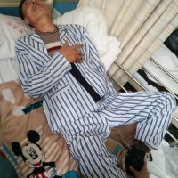 老父56岁,一氧化碳中毒迟发性脑病,望各位救救