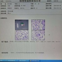 请大家救救身患印戒细胞癌的我,病如山倒