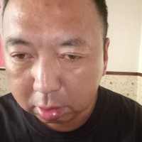 帮帮我!让身患肺气肿哮喘气管炎的我在人世上