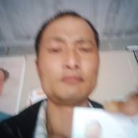 双肾结石,重度积水,小便出血,需两次手术,右肾己