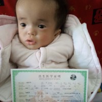 龙凤胎女孩脑积液住院没钱治,办了预约住院,我