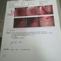 一直帮助别人 没想到大病来到我身上