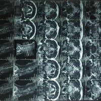 恳求大家帮助我父亲站起来!