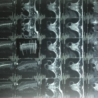 恳求大家帮助我父亲站起来!