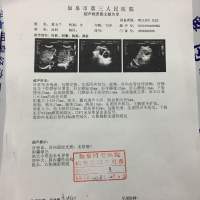 生命接力!希望大家可以帮助夏玉兰活下去。