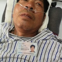 千里看女儿意外摔伤脊椎压迫神经四肢瘫急需手