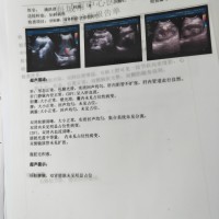 满洪君_宫颈癌_证明材料