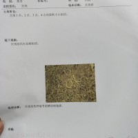 满洪君_宫颈癌_证明材料