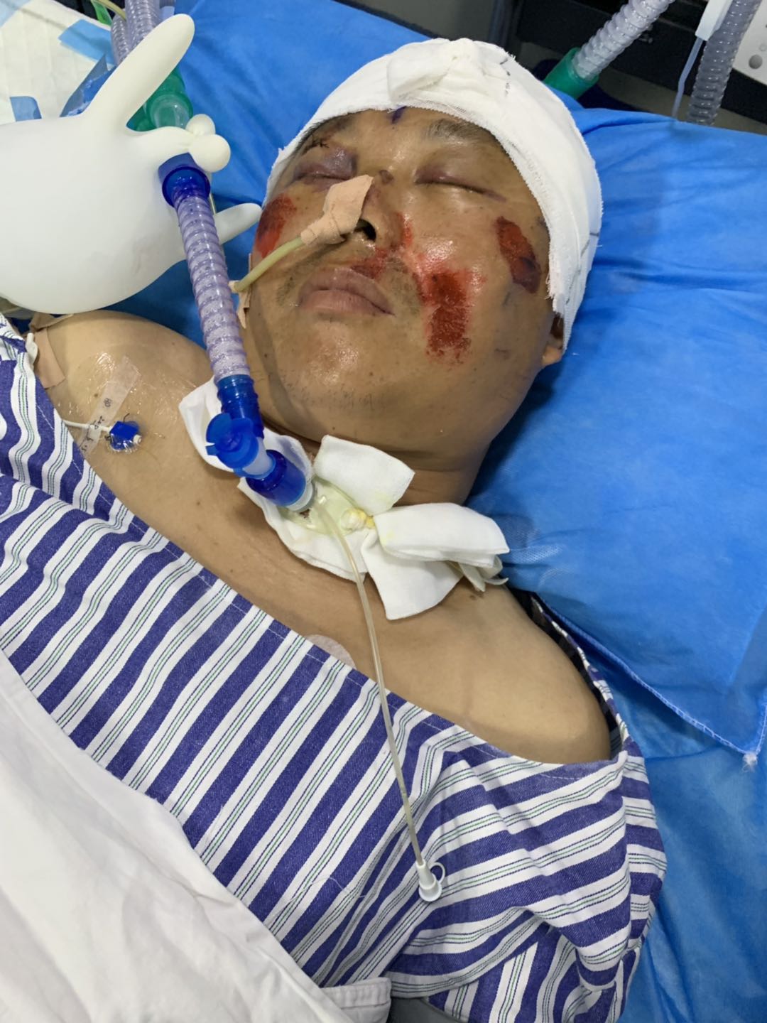 案例详情
